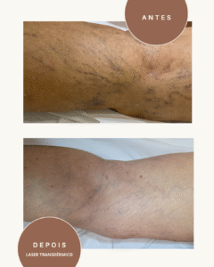 Green and Beige Minimalist Skincare Before After Collage Instagram Post (1)