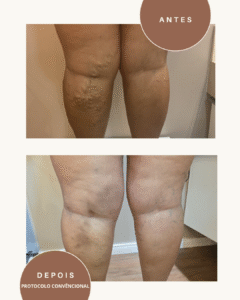 Green and Beige Minimalist Skincare Before After Collage Instagram Post (2)