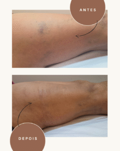 Green and Beige Minimalist Skincare Before After Collage Instagram Post