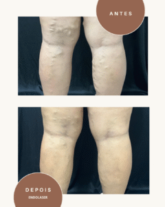 Green and Beige Minimalist Skincare Before After Collage Instagram Post (3)